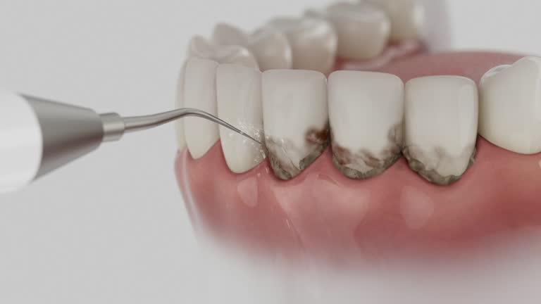Reliable Dental Implants contractor in Kermit, TX by Smile Center Dentistry